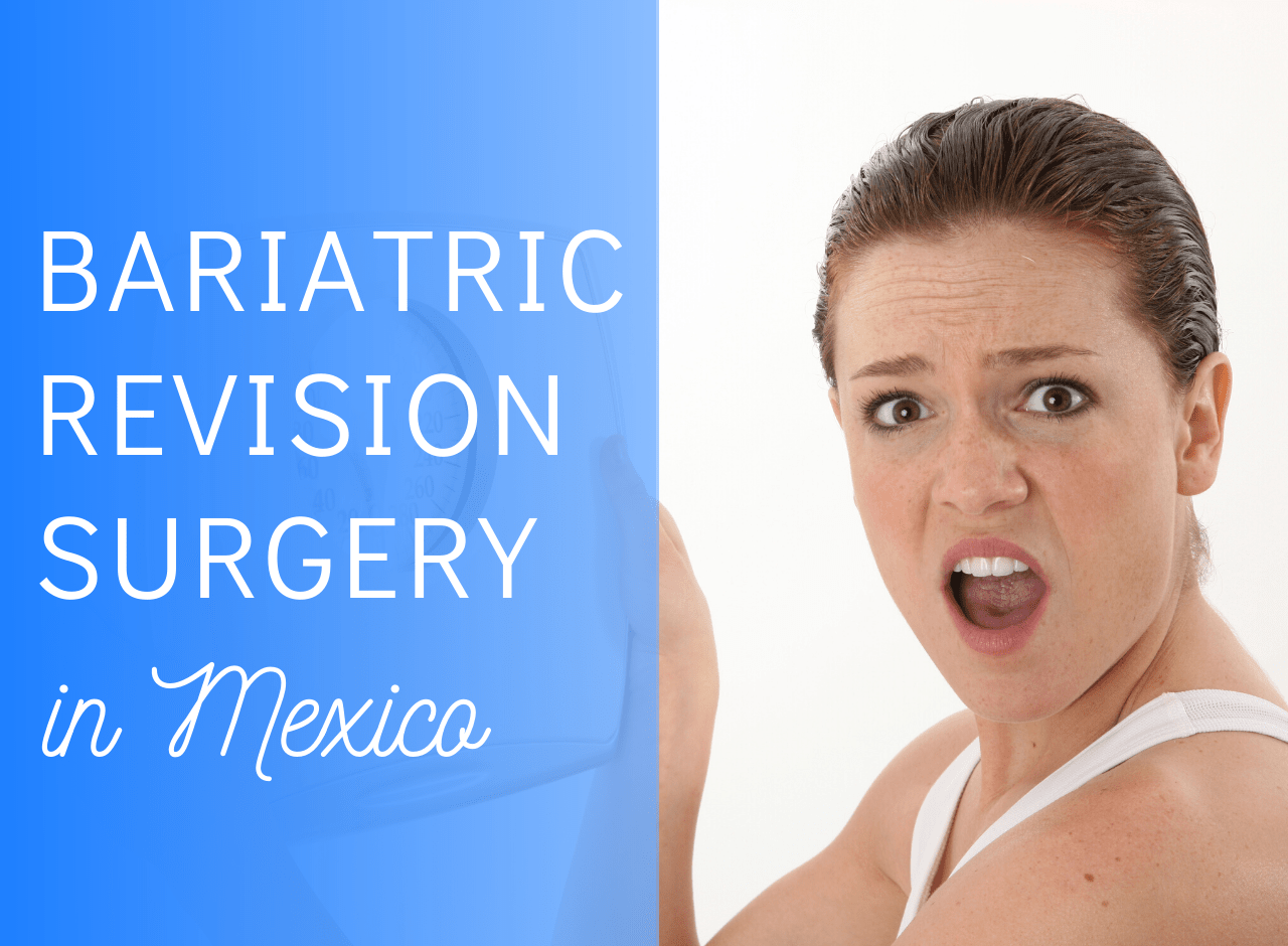 Gastric Bypass Surgery Revision - Tijuana, Mexico Resizing Stomach Pouch