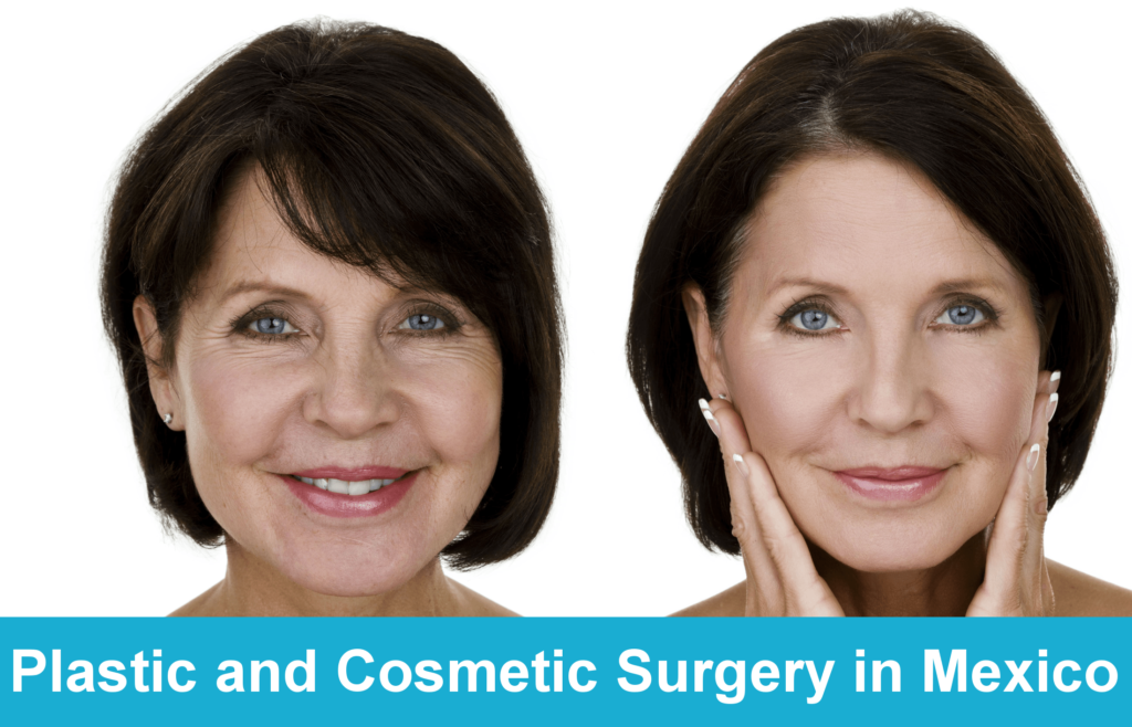 Plastic and Cosmetic Surgery in Mexico - Tijuana Bariatrics Center